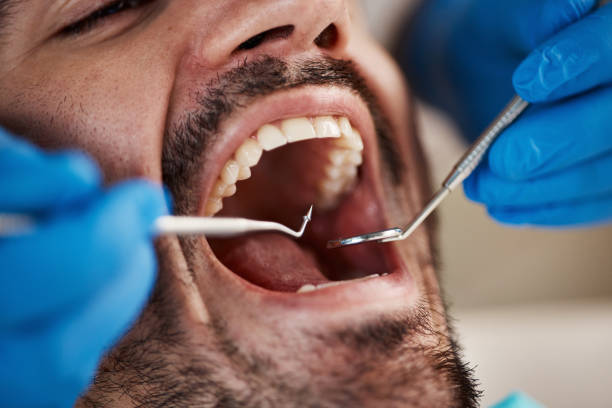 Best Emergency Dentist for Special Needs Patients in Attica, IN